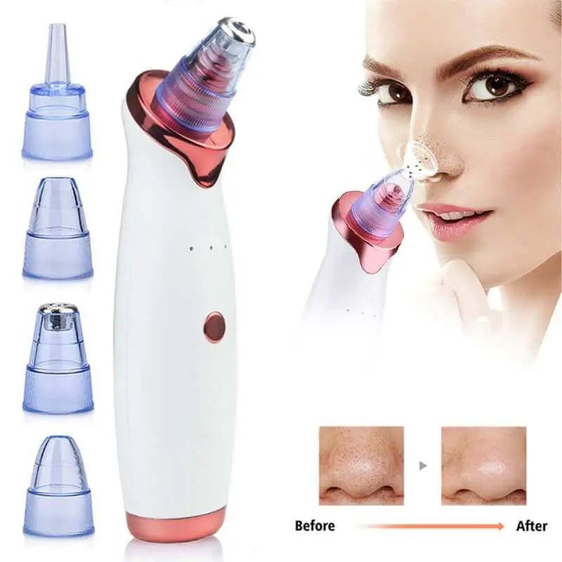 Electric vacuum facial blackhead remover with multiple suction heads for clear skin.